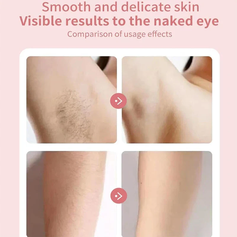 2024 Best Silk Glide Razor, Lady Shaver, Silk Glide Epilator Painless Hair Removal at Home, 2 in 1 Electric Shaver Razors for Women, for Sensitive Skin, Wet & Dry - Image 2