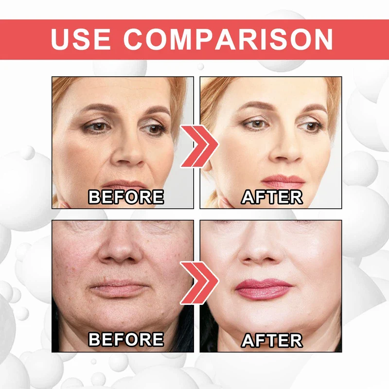 3Pcs EELHOE Collagen Boost Anti Aging Serum, EELHOE Collagen Anti-Wrinkle Cream, Voletas Collagen Boost Anti-Aging Serum - Image 5