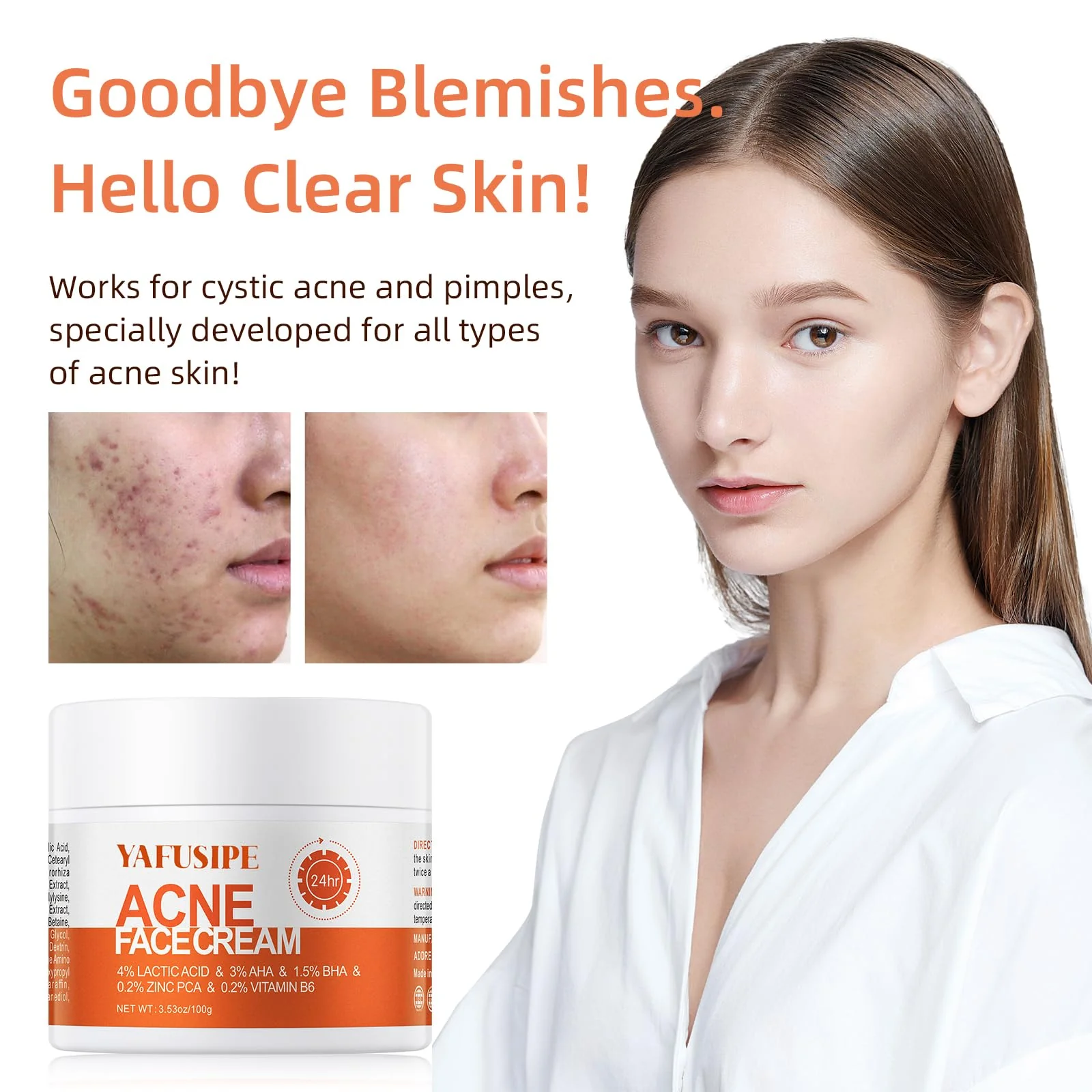 Acne Treatment for Face for Hormonal Cystic Stubborn Acne Cream for Sensitive Skin Teens Adults Women Men Spot Pimple Butt Control Rapid Clearing Breakout Overnight Face Blemish Treatment Moisturizer - Image 8