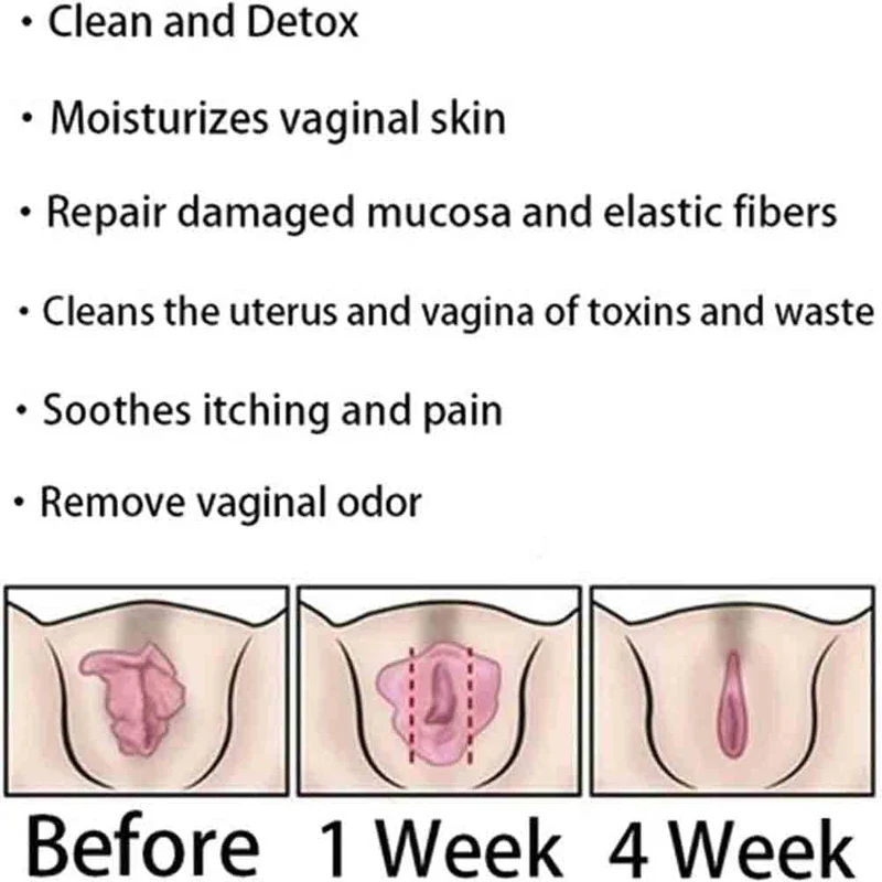 AnnieCare Instant Anti-Itch Detox Products, Annie Care Capsulas, Firming Repair & Pink and Tender Natural Capsules, Annie Care Capsulas (8Bag) - Image 6