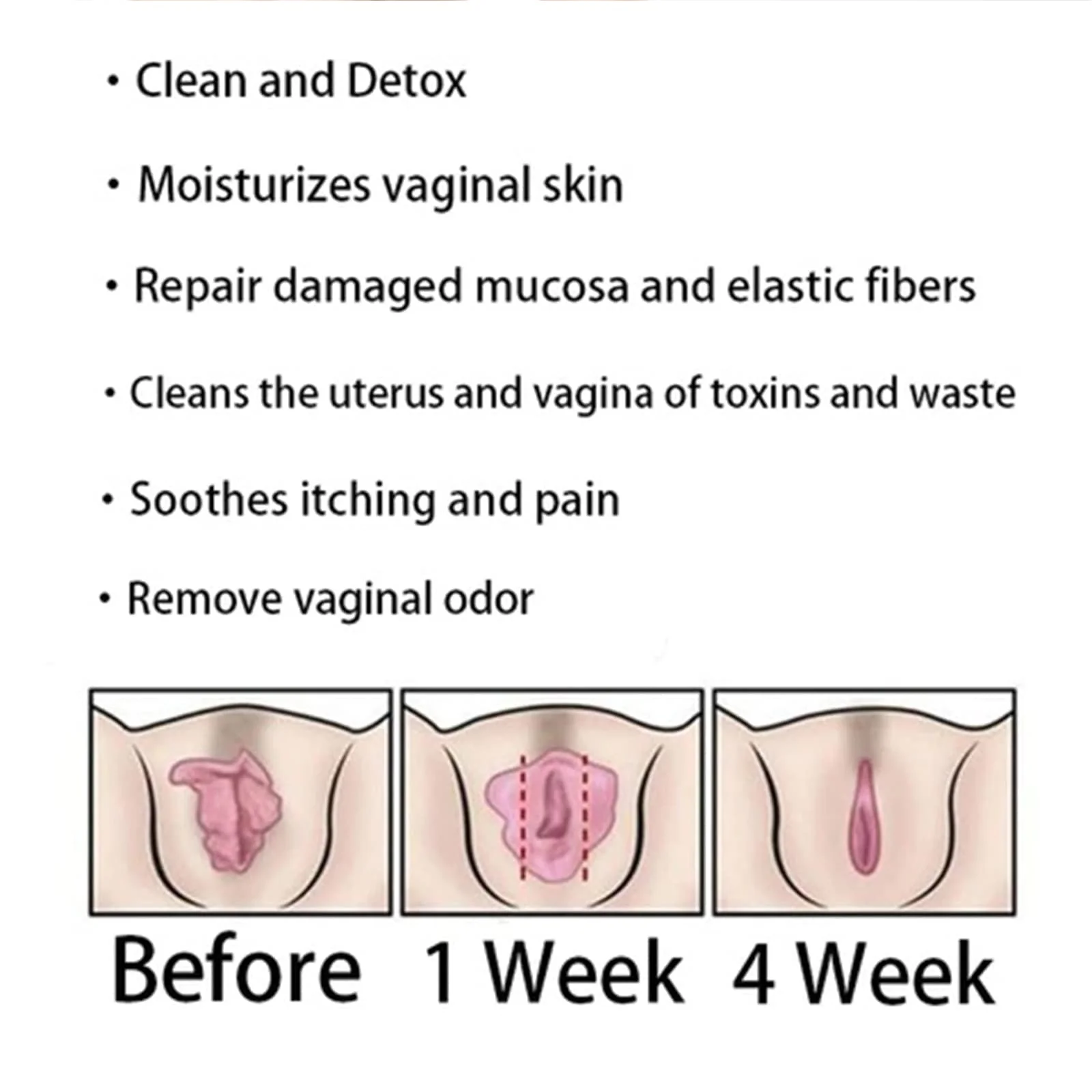 AnnieCare Instant Anti-Itch Detox Slimming Products,Annie Care Capsulas, Firming Repair & Pink and Tender Natural Capsules (2PCS) - Image 3