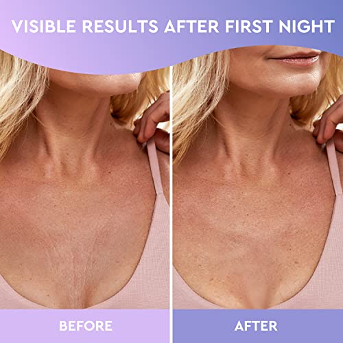 Cleverfy Silicone Chest Wrinkle Pads for Décolleté - 3-Pack of T-Shape Reusable Anti-Wrinkle Patches - Image 3