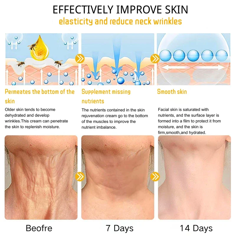 Bee Lift Anti Aging Firming Body Cream, Bee Venom Wrinkle Removal Cream, Collagen Firming Body Lotion, Neck Firming Cream For Loose Skin, Skin Tightening Cream Body, Restore Elasticity, Hydration - Image 5