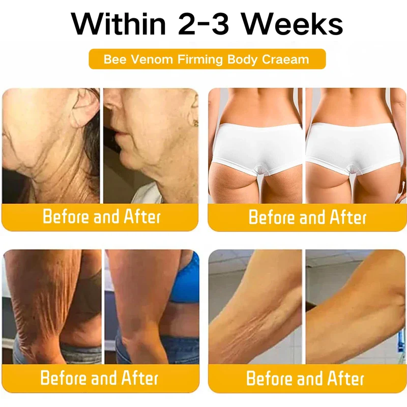 Bee Lift Anti Aging Firming Body Cream, Bee Venom Wrinkle Removal Cream, Collagen Firming Body Lotion, Neck Firming Cream For Loose Skin, Skin Tightening Cream Body, Restore Elasticity, Hydration - Image 7