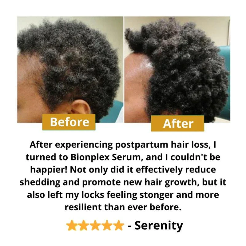 BIONPLEX 100% Organic Hair Growth Serum For Thinning Hair Loss - More Bottles:: 3 Pics - Image 9