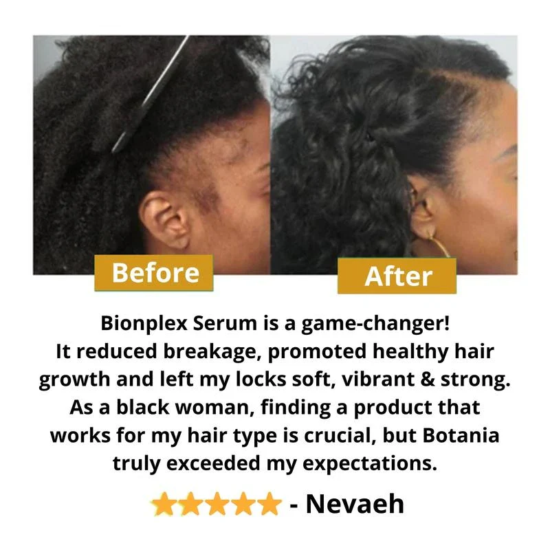 BIONPLEX 100% Organic Hair Growth Serum For Thinning Hair Loss - More Bottles:: 6 Pics - Image 6
