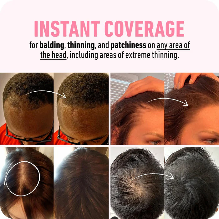 BOLDIFY Hairline Powder Instantly Conceals Hair Loss, Root Touch Up Hair Powder, Hair Toppers for Women & Men, Hair Fibers for Thinning Hair, Root Cover Up, Stain-Proof 48 Hour Formula (Light Blonde) - Image 8