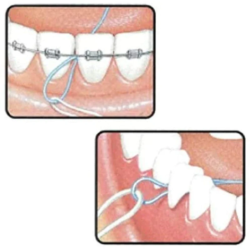 Butler Floss Threader, Pack of 5, Set of 10 - Image 3