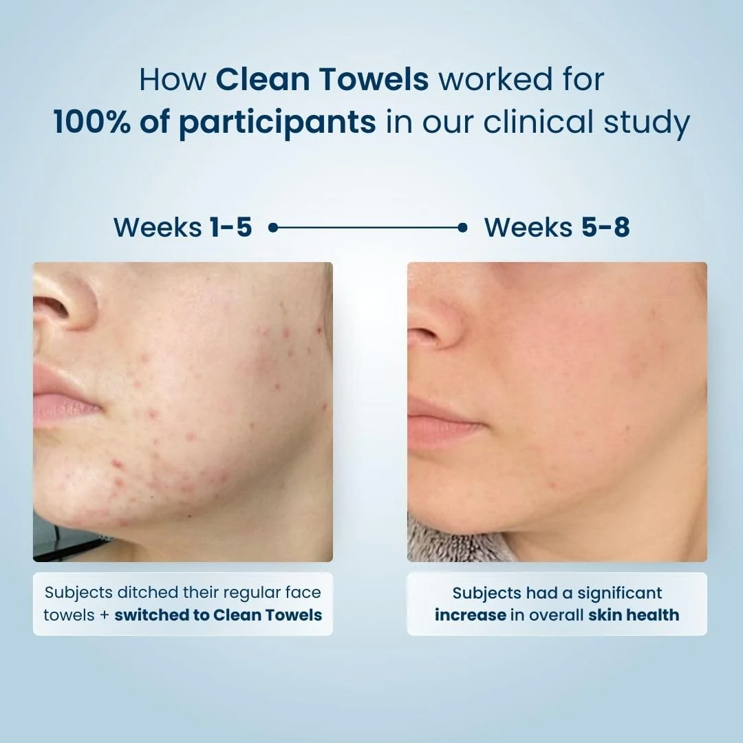 Clean Skin Club Clean Towels XL™, 100% USDA Biobased Face Towel, Disposable Face Towelette, Eczema Association Accepted, Makeup Remover Dry Wipes, Ultra Soft, 100 Ct, 2 Pack - Image 4