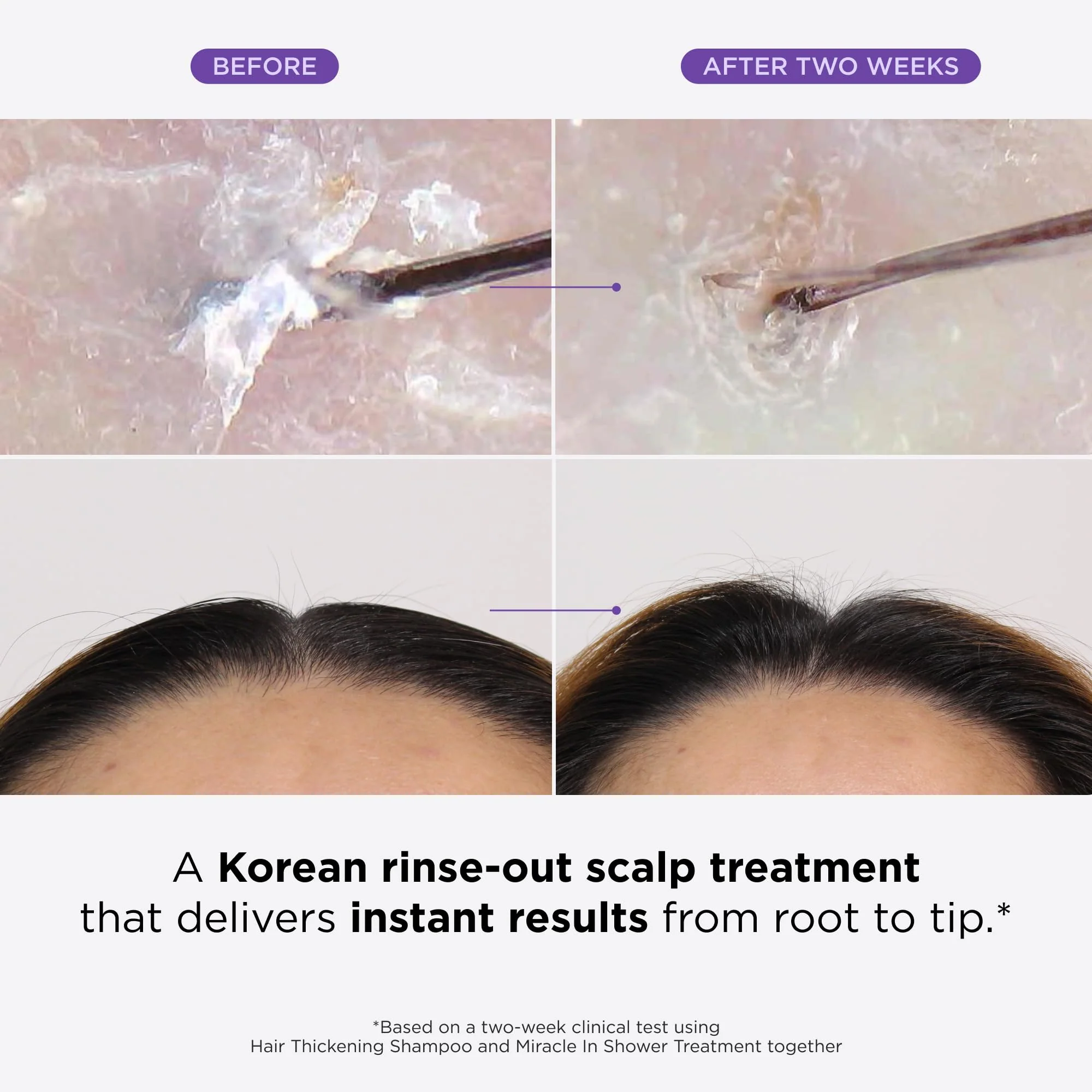 Dr. Groot Miracle in Shower Treatment for Hair Loss, Korean Hair Care, 5 Seconds to Smooth Hair, Rosemary Oil for Healthier-Looking Hair, Hair Rinse, Moisturizing Treatment,Scalp Revitalizing Solution - Image 9