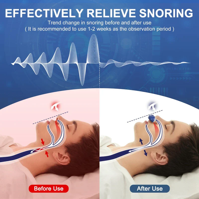 Electric Anti Snoring Device,Stop Snoring Solution,Adjustable Wind Speed Anti Snoring Devices,Breathable Snoring Prevention for Men Women,Universal All Nose Shapes (Blue) - Image 3