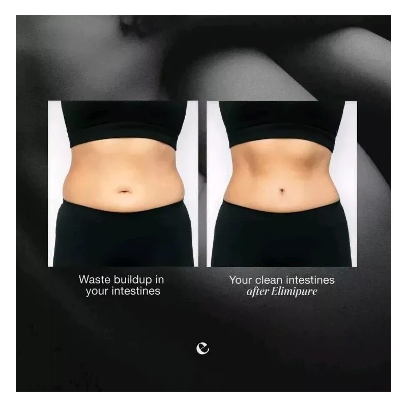 Emma Relief Elimipure Inner Balance Intestinal/Col - Image 4