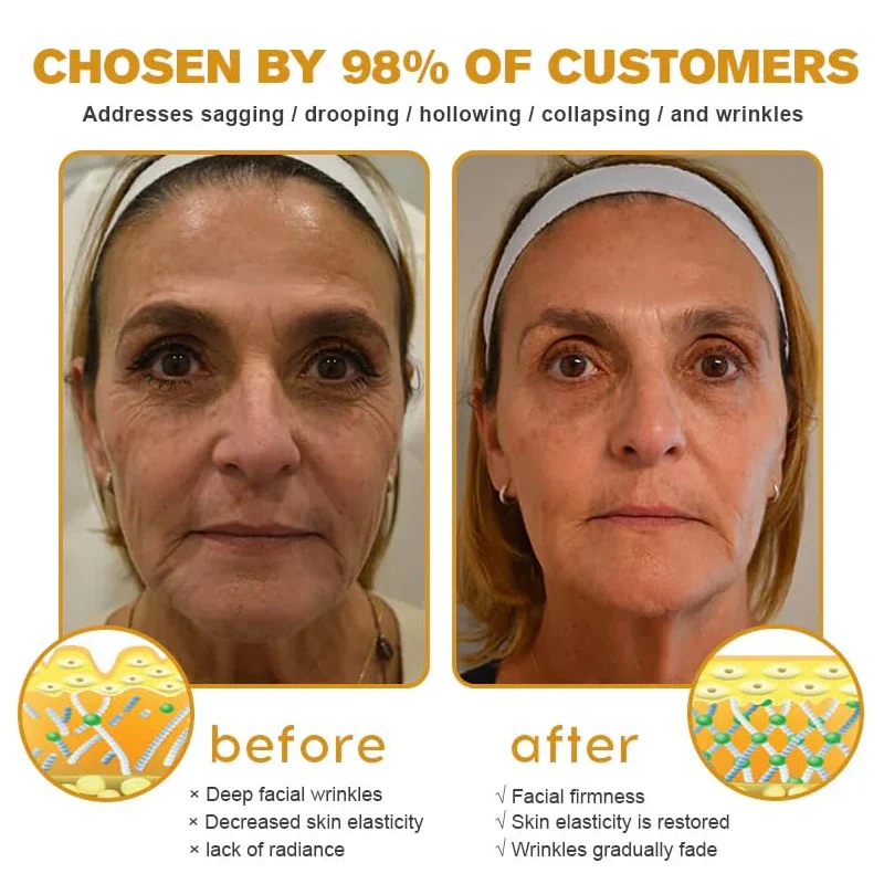 Furzero Bee Venom Wrinkle Removal Cream, Furzero Bee Venom Anti-Wrinkle Cream, Advanced Skin Firming Cream, Anti-Aging Moisturizer for Face & Neck,Anti-Aging Bee Venom Cream (2pcs) - Image 6