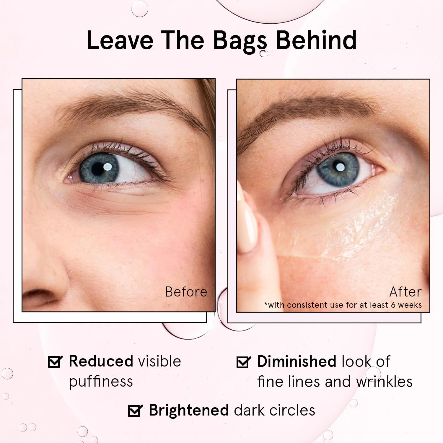 grace & stella Award Winning Under Eye Brightener Roller - Airplane Travel Essentials - Retinol & Caffeine Eye Serum for Puffiness, Dark Circles, Wrinkles - Vegan Skincare (15ml / 0.51floz) - Image 8