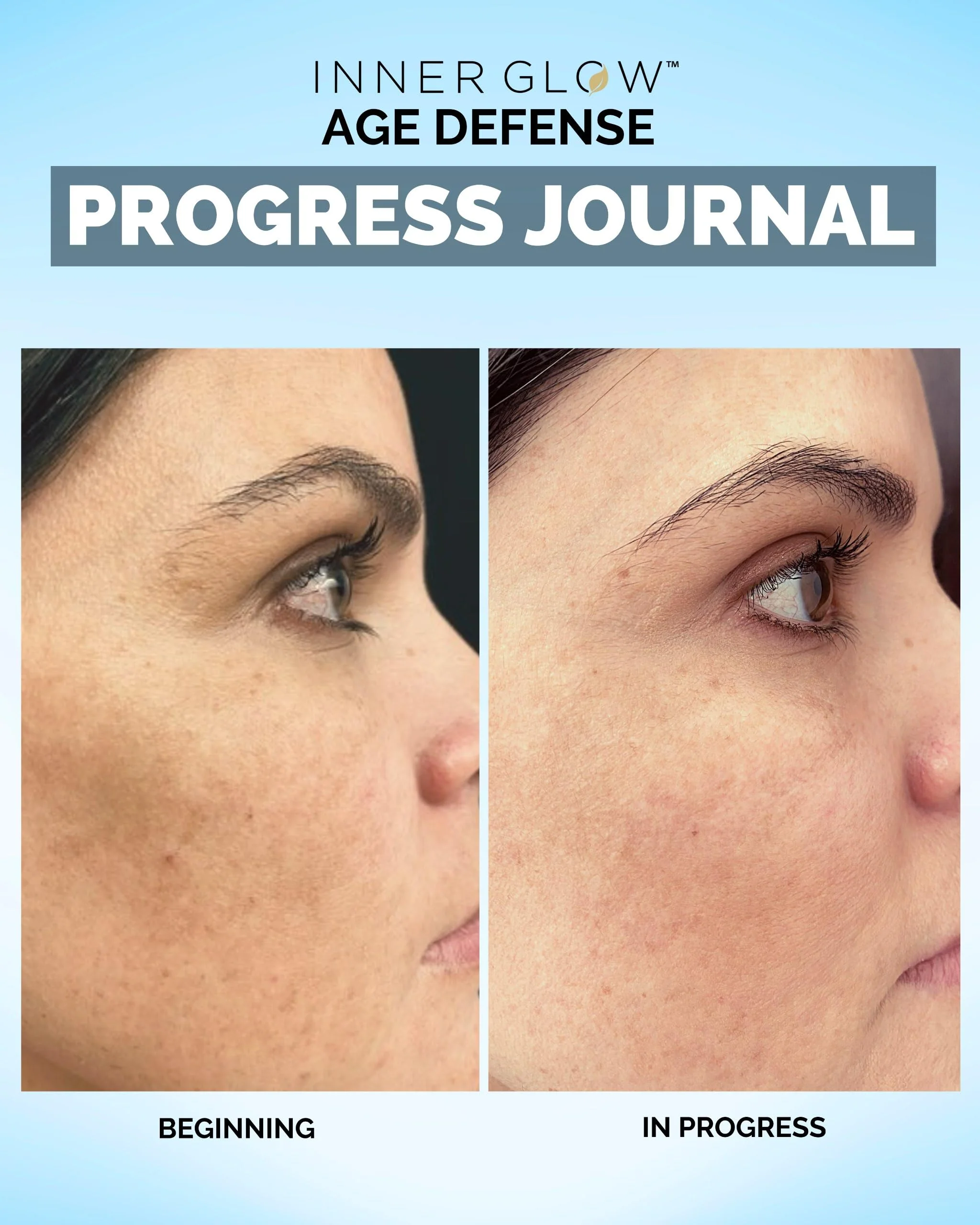 Inner Glow Age Defense Vitamins - Dermatologist and Plastic Surgeon Developed to Fight photoaging and Melasma, Polypodium Leucotomos Antioxidant Formula – Vegan, Gluten-Free – 60 Capsules - Image 8