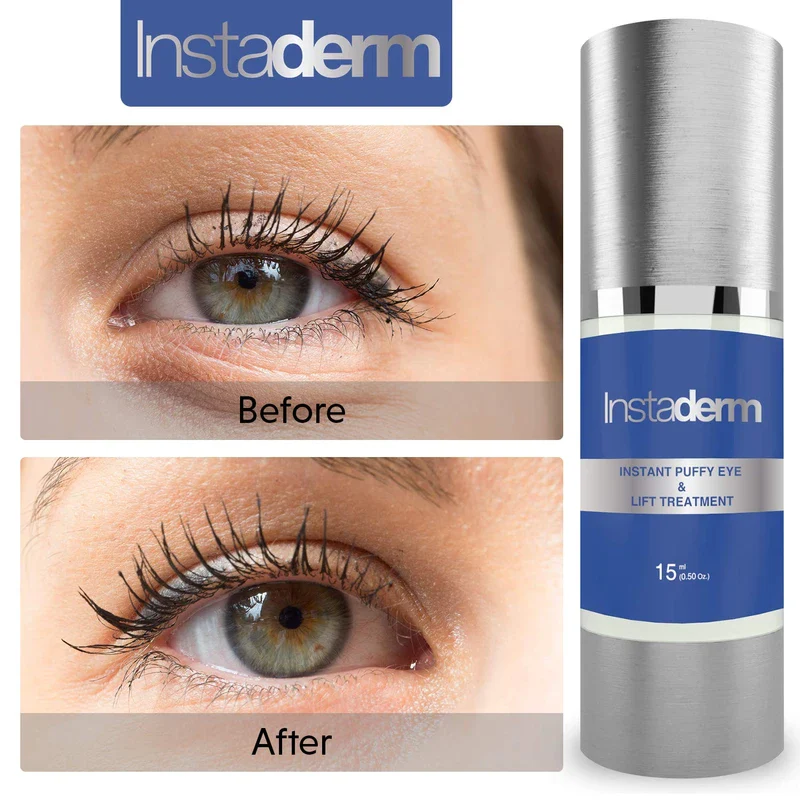 Instant Puffy Eye & Lift Treatment – Removes Under Eye Bags & Puffiness. Eliminate Dark Circles & Wrinkles. Naturally Ageless Hydrating Cream. Disappears Before Your Eyes Within Minutes. - Image 3