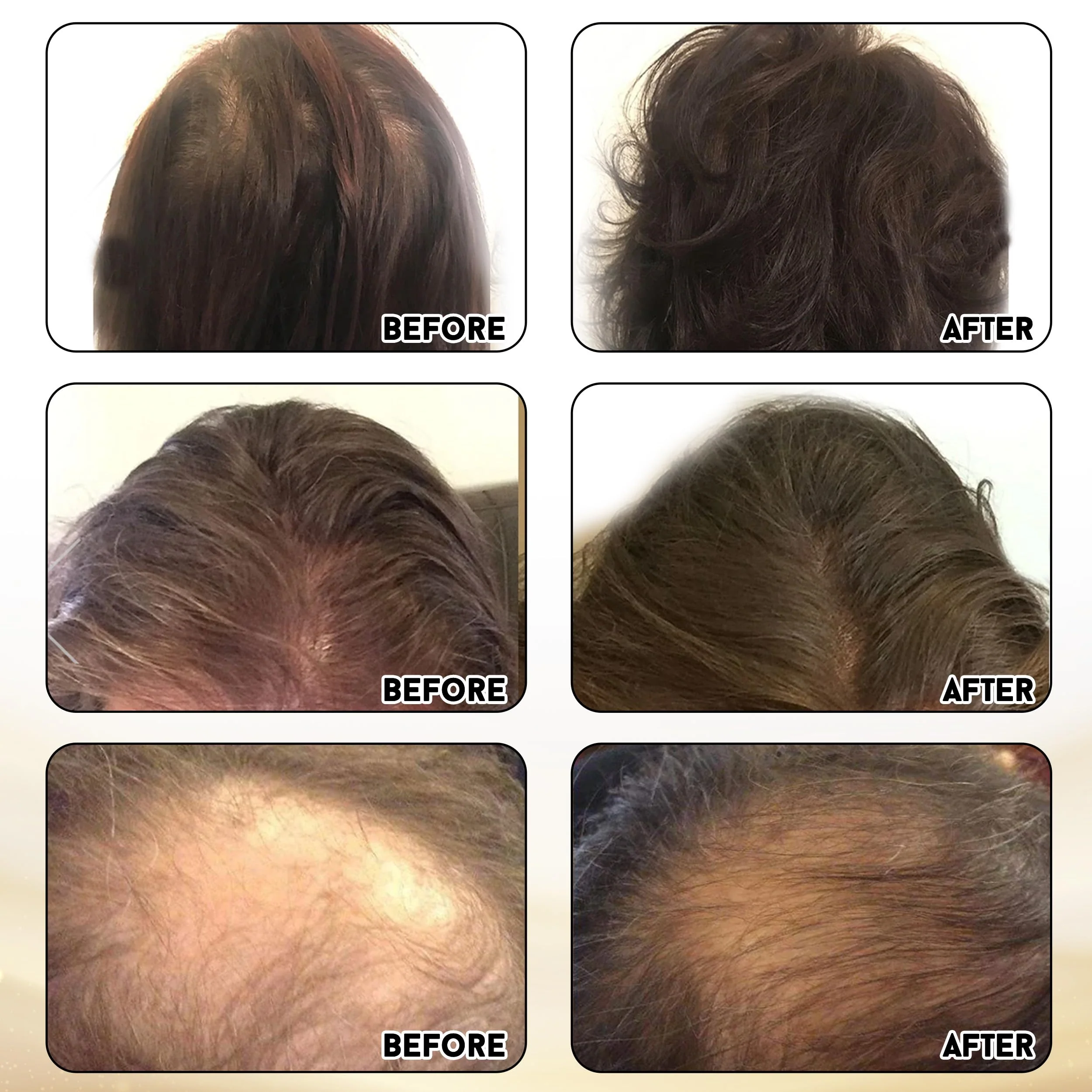 Joyce Giraud Ultimate Hair Strength Supplements 30-Day Supply, Scientifically Formulated to Reduce Hair Loss, 60 Capsules - Image 3