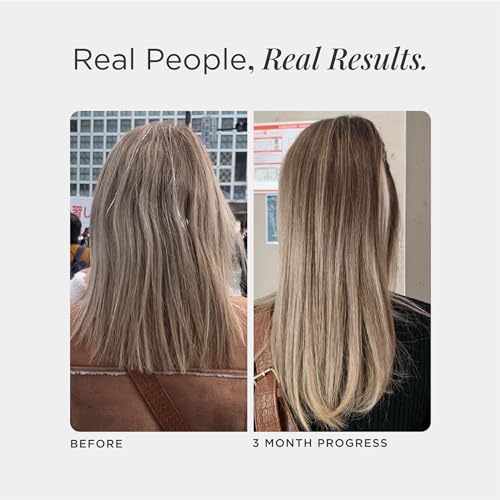 JSHealth Vitamins Hair and Energy Formula Hair Growth Vitamins | Hair Vitamins for Women and Men | Zinc and Iodine Hair Supplements for Hair Growth | Hair Loss Supplements | (30 Capsules) - Image 5