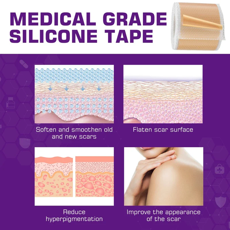 Kelinul Silicone Scar Sheets(1.6 x 120"Roll-3M) Scar Removal Silicone Scar Tape for Softening and Flattening Scars, Acne, C-Section, Keloid Surgery, Painless Removal, Reusable, Washable, 10-12 Month Supply - Image 5