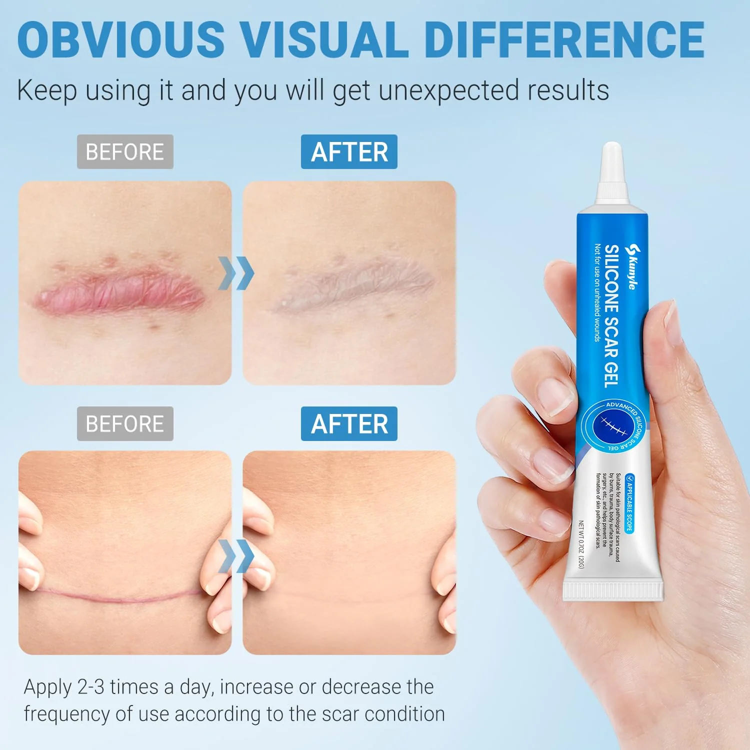 Kunyle Silicone Scar Gel, Scar Cream, Advanced Scar Gel for Surgical Scars, Stretch Marks, Keloid Bump Removal, Old and New Scars 0.70oz (20g) - Image 8