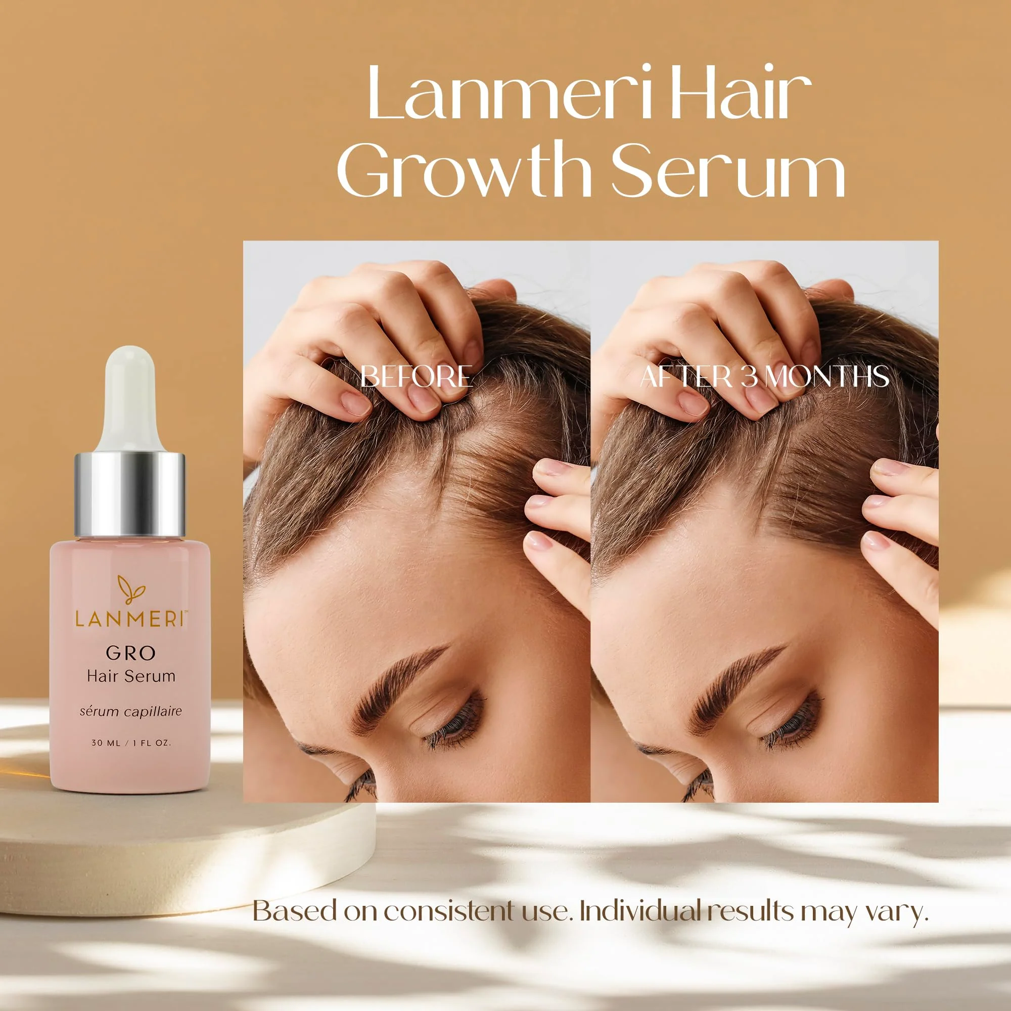 Lanmeri Vegan Hair Growth Serum - Natural Hair Regrowth and Hair Loss Treatments for Women & Men - Scalp Serum for Thinning Hair - Fuller, Thicker and Healthier Hair in 90 Days, All Hair Types - Image 8