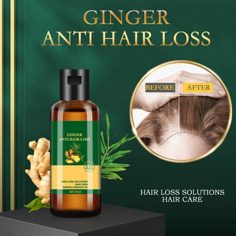 Lidoria Ginger Anti Hair Loss 7 Days, Ginger Essential Oil for Hair Growth Stronger and Fuller Hair, Hair Growth Serum for women for Dry Damaged Hair, Thicker Longer Hair (1.2 Oz(Pack of 2)) - Image 2