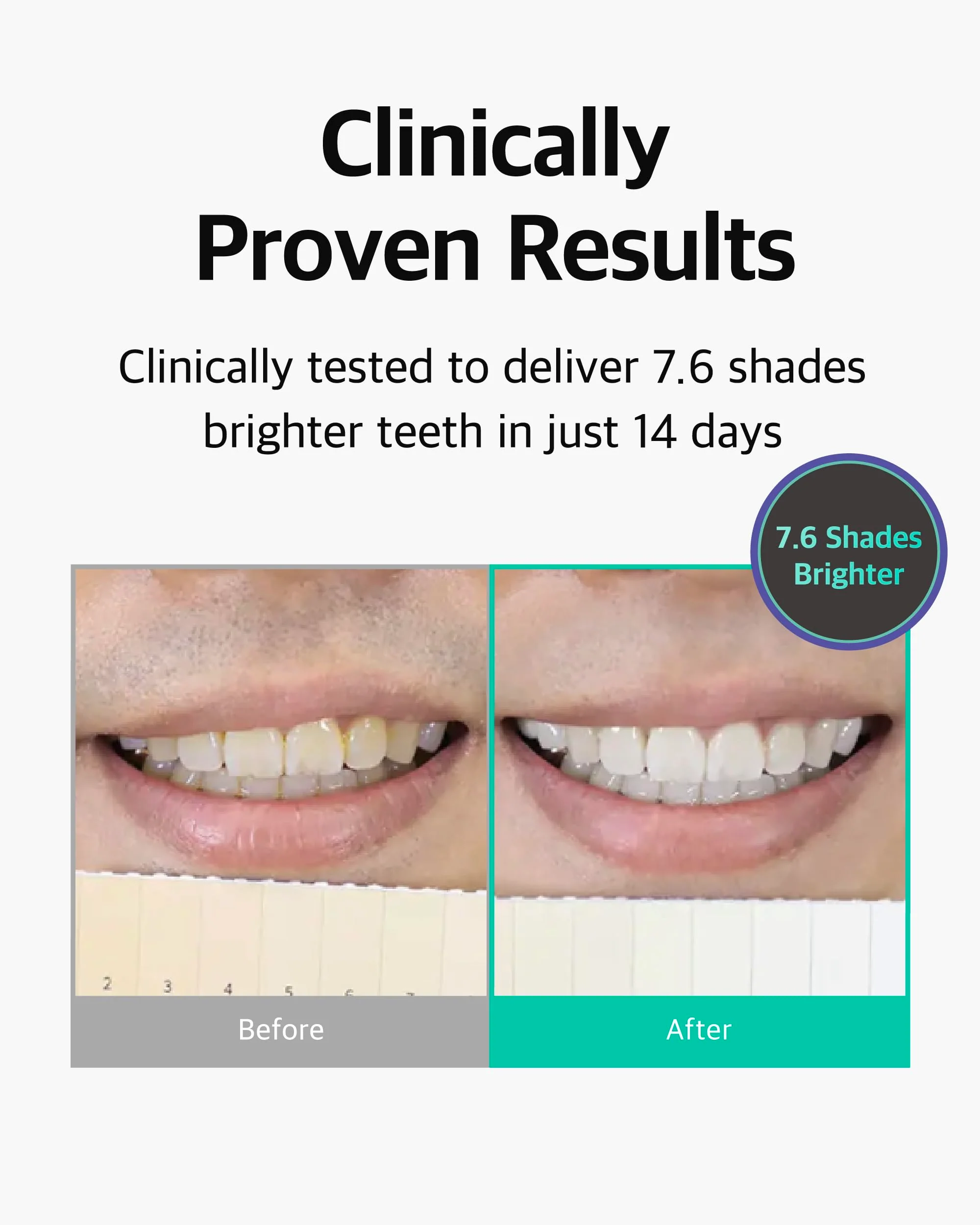 Live Orals PureDia Teeth Whitening Kit - Gel & Mouthpiece Set, Hydrogen Peroxide, Dentist Formulated for Sensitive Teeth, 28 Treatments. - Image 4