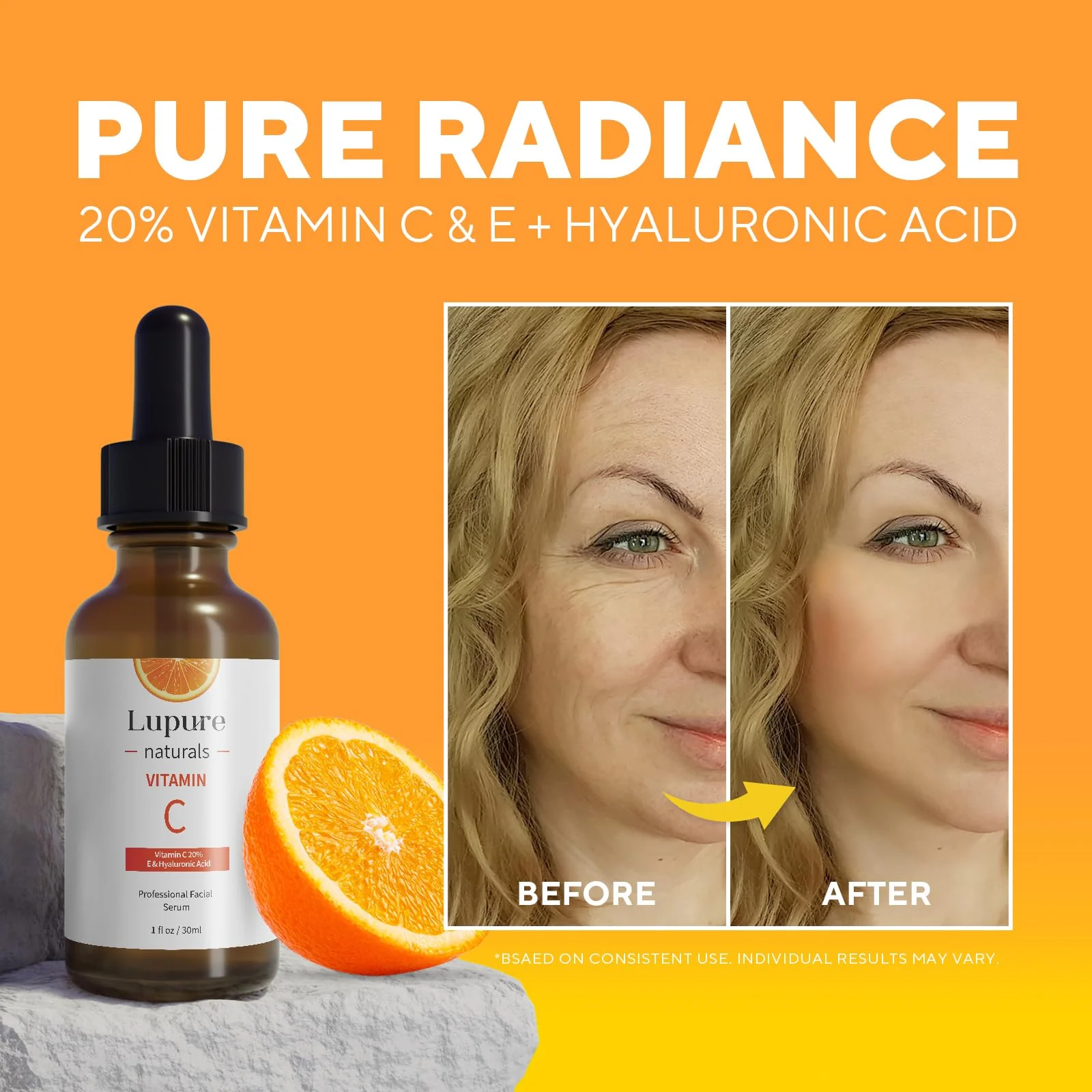 Lupure Professional Vitamin C Face Serum 20%, Anti Aging Facial Super Vit C Serum with Ascorbic Acid Hyaluronic Acid & Vitamin E for Dark Spots, Skin Care, Christmas Gift & Stocking | 1 Fl. Oz - Image 7