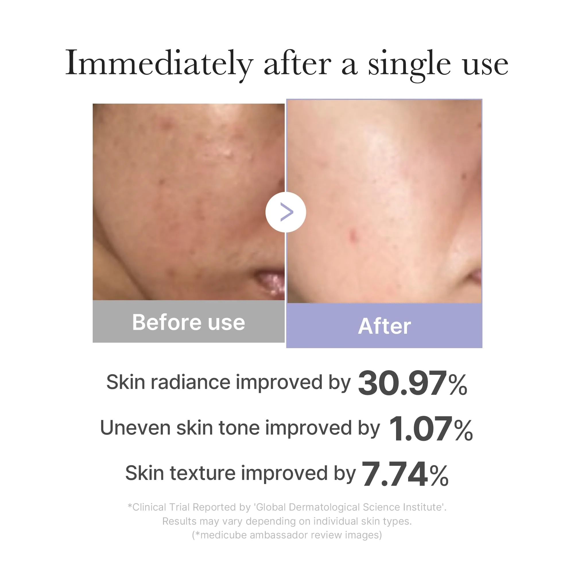 medicube Mini Booster Pro White | Affordable At-Home Facial Skin Care Tool for Beginners - Portable Glow Booster for Glass Skin, Boosting Skin Care Absorption, Skin care for teens, Korean Skin Care - Image 5