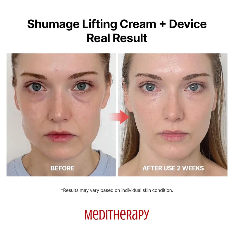 MEDITHERAPY Shumage Gold Seal Lifting Cream+Device, Ultimate Lifting and Tightening for Sagging Skin, Facial Device for Radiant Glow Skin, Elasticity, Anti-Wrinkle - Image 4