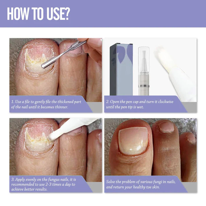 Nail Care Treatment Pen - Strengthener & Cuticle Oil - Image 2