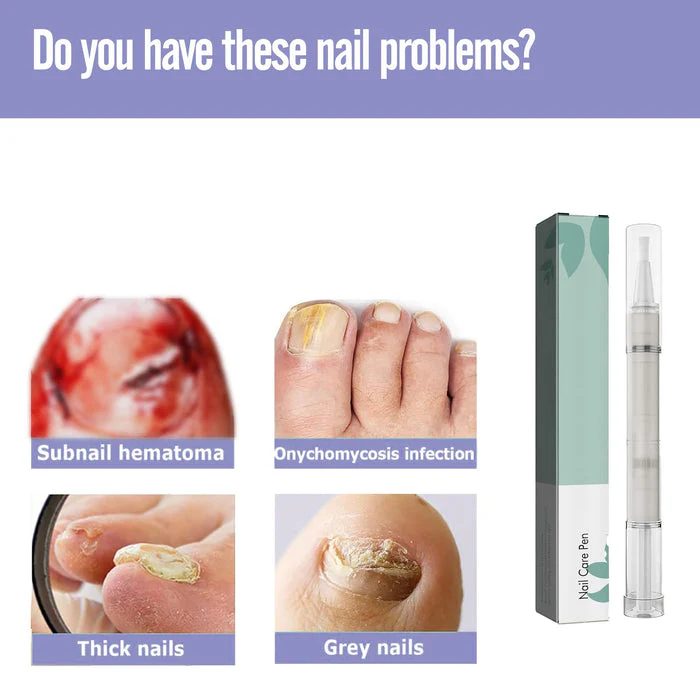 Nail Care Treatment Pen - Strengthener & Cuticle Oil - Image 4