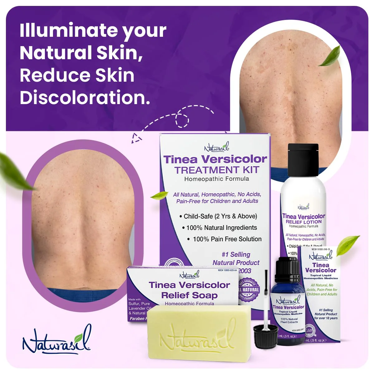 Naturasil Tinea Versicolor Treatment +2 Bars | Max-Strength 10x Soap | Antifungal Micronized Sulfur | Stops Pityriasis, Candida, Ringworm & Irritation | Fast Acting Adult & Kid Safe | 4 oz (2 Pack) - Image 3