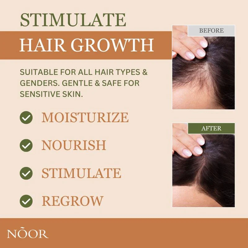 Noor Hair Rosemary Growth Spray - Hair Growth with Rosemary, Green coffee bean, Biotin, Cynatine Keratin, and MCT Oil from Palm Leaves - Thicker Hair - Scalp Itchiness Relief - 2 FL Haircare Nourishing - Image 3