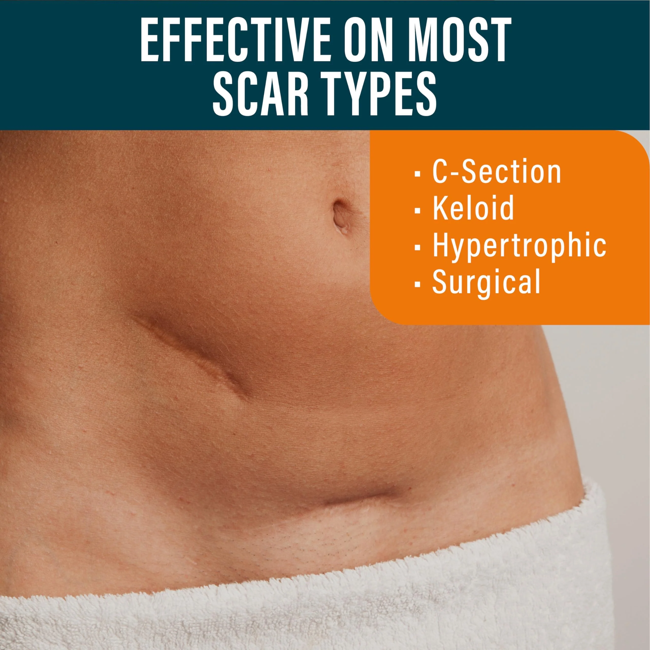 NUVADERMIS Silicone Scar Sheets - Extra Long Scar Sheets for C-Section, Tummy Tuck, Keloid, and Surgical Scars - Reusable Medical Grade Silicone Scar Sheets - Pack of 4 - Light Tone - Image 7