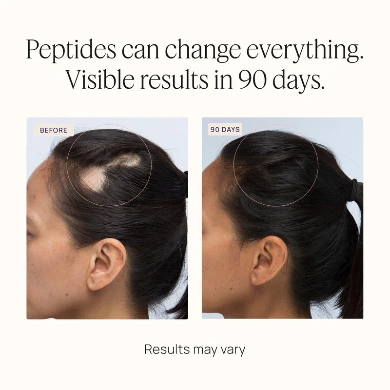 OMI WELLBEAUTY OMI WELLBEAUTY Women's Hair Growth Peptides Gummies, Doctor Recommended, Follicle Fortifying Biotechnology, Clinically Proven to Visibly Grow More Hair and Reduce Hair Loss, 1-Month Supply - Image 5