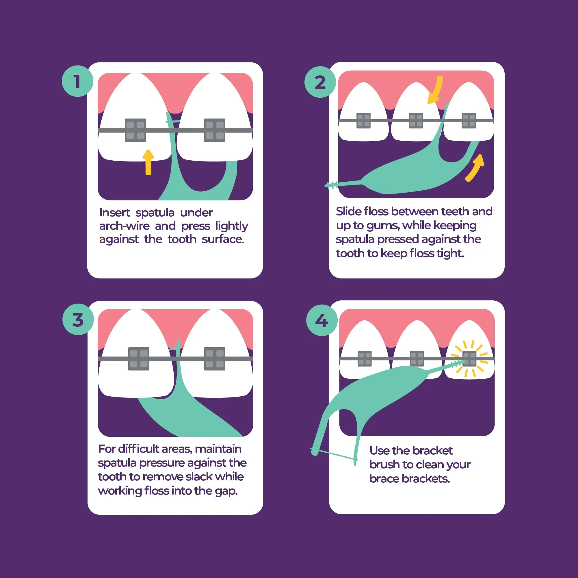 Platypus Orthodontic Flossers for Braces Family Pak - Unique Structure Fits Under Arch Wire, Increase Flossing Compliance, Floss Teeth in Less Than Two Minutes - 75 3-Count Flossers (225 Total) - Image 3