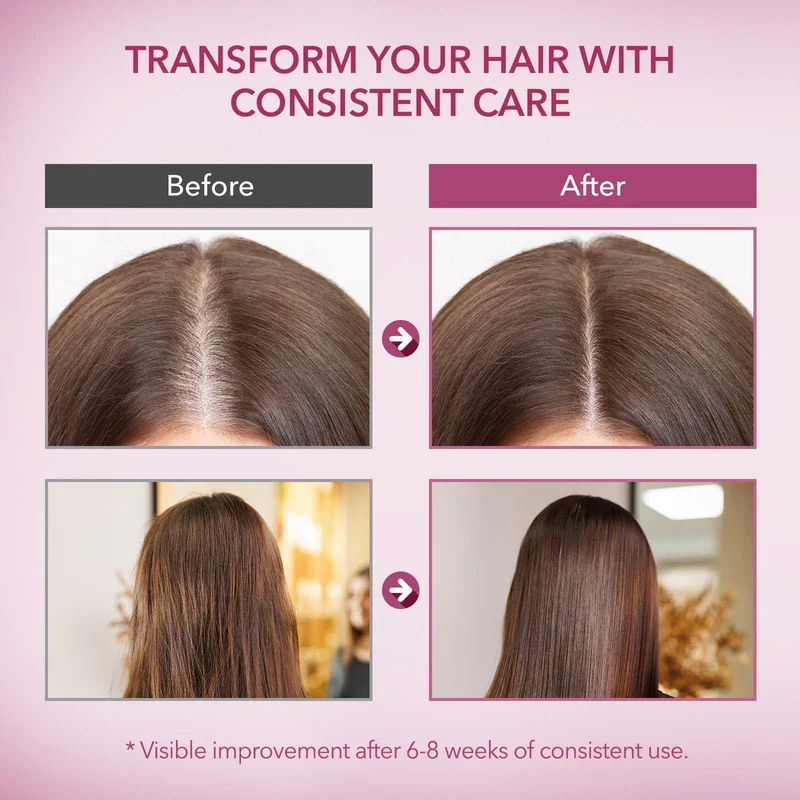 ProBliva Onion & Rosemary Hair Growth Shampoo: Biotin Infused Shampoo for Hair Loss and Thinning Hair - Promotes Healthier, Thicker and Stronger Hair for Women and Men - 16.9 oz - Image 6