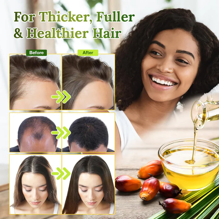Raw Batana Oil for Hair Growth, 100% Natural, Pure, Unrefined and Organic Dr. Sebi Batana Oil Raw from Honduras Prevent Hair Loss and Enhances Hair Thickness in Men & Women - Image 3