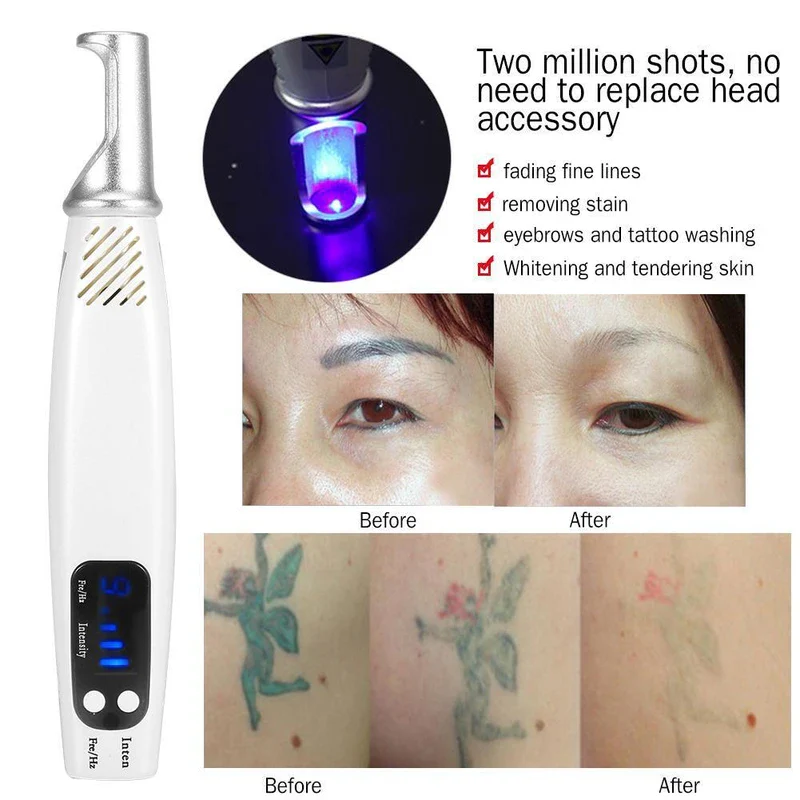 Red/Blue Light Picosecond Laser Tattoo Removal Pen Mole Dark Spot Remover tool - Image 10