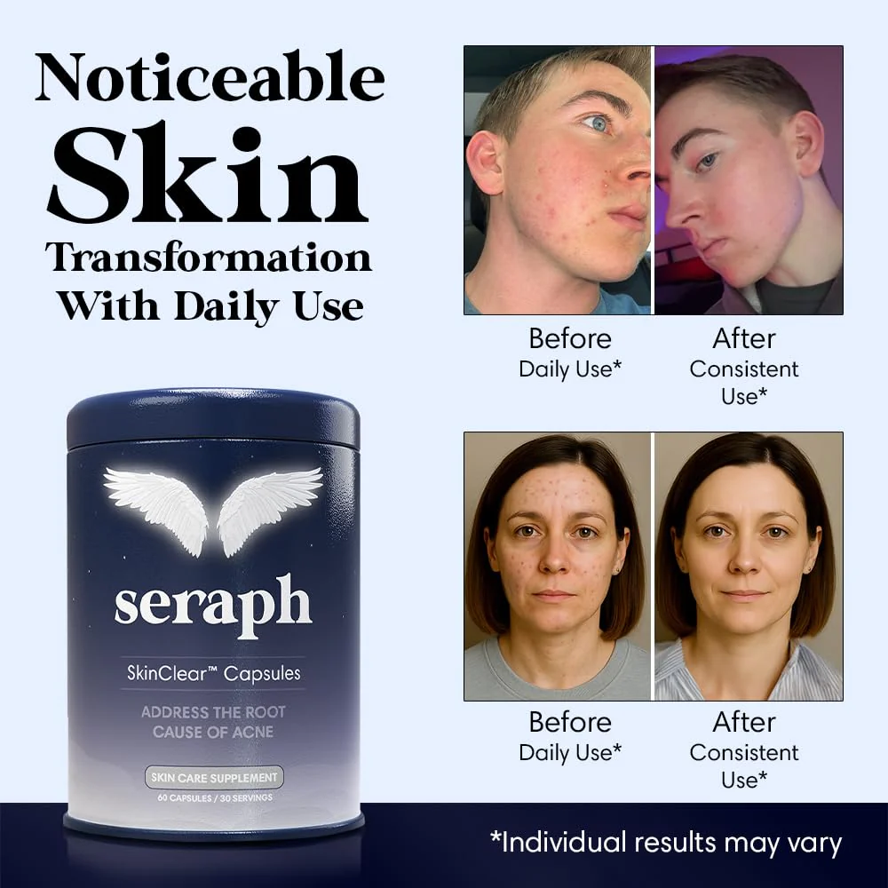 Seraph Acne Supplement - Hormonal Acne Pills Treatment - Pimple Supplements for Women - Skin Care Supplement for Teen, Men, & Adults - Made in USA - 60 Tablets - Image 8