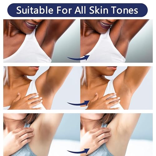 Skin Lightening Cream Skin Bleaching Cream Whitening Cream For Body Intimate Area, Private Parts, Underarm, Knees, Elbows, Inner Thigh, Bikini Areas - Image 4