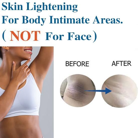 Skin Lightening Cream Skin Bleaching Cream Whitening Cream For Body Intimate Area, Private Parts, Underarm, Knees, Elbows, Inner Thigh, Bikini Areas - Image 6