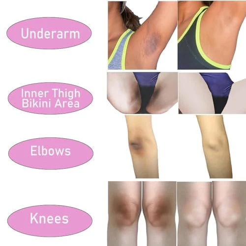Skin Lightening Cream Skin Bleaching Cream Whitening Cream For Body Intimate Area, Private Parts, Underarm, Knees, Elbows, Inner Thigh, Bikini Areas - Image 7