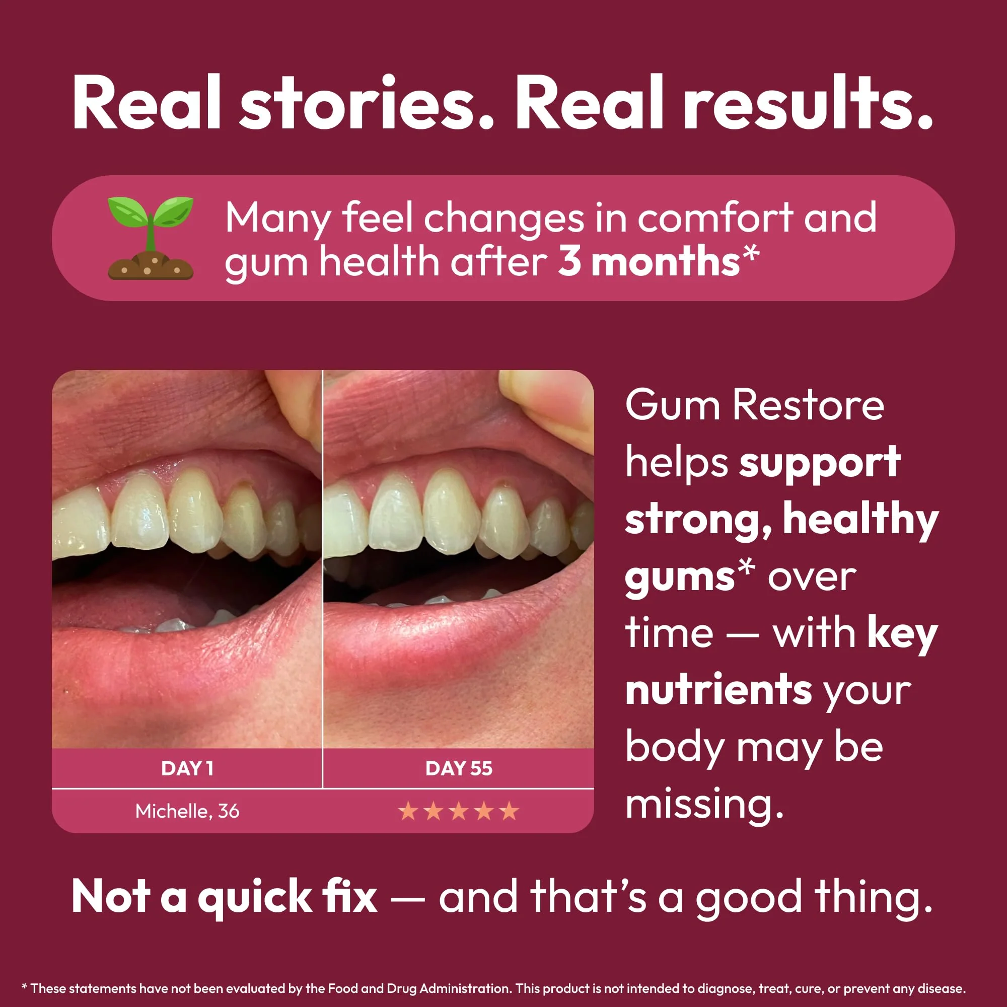Strong Jaw Gum Restore - Gum Care + Teeth Vitamins - Gum Health & Oral Health - Supports Receding Gums & Gum Care - Dental Vitamins for Adults – 180 Capsules, Non-GMO Gum Health Supplements - Image 6