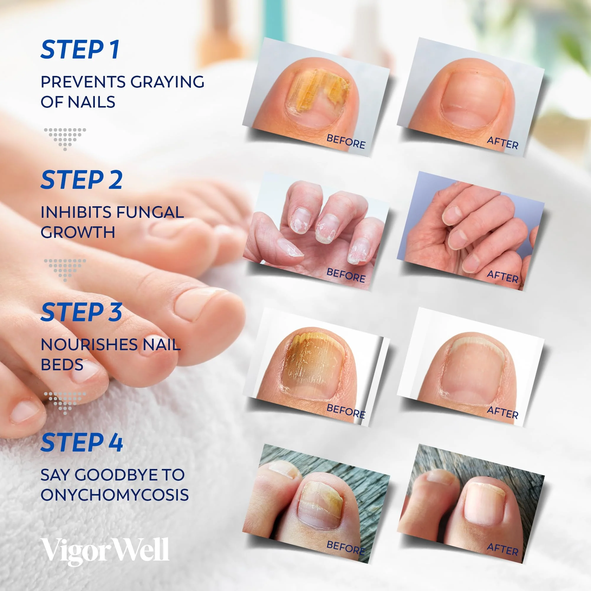 Toenail Fungus Treatment Extra Strength - (Medium) 32 Nighttime Hydrogel Patches for Overnight Toenail Repair - Visible Results in 8 Hours - Fungal Nail Patches for Toenail Fungus Relief - Image 6