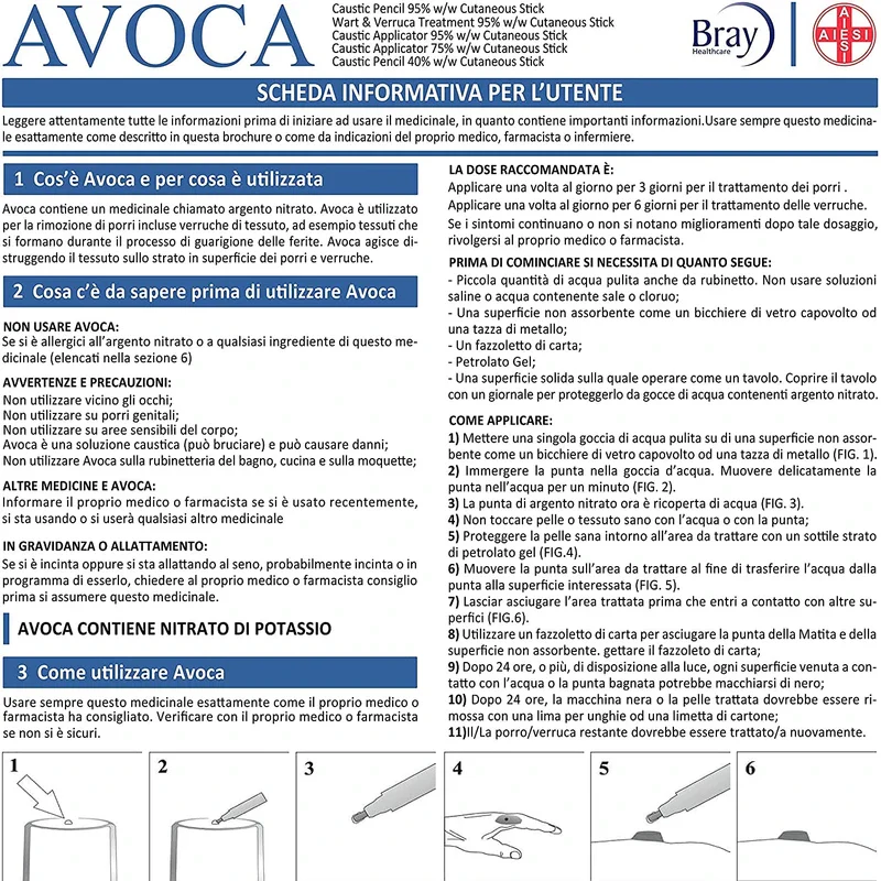 Vet Caustic Silver Nitrate Styptic Pencil 1 Pack - Image 9