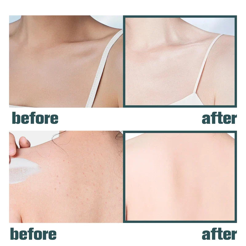 YFKEJI LuxeLift Skin Firming Youth Butter, Luxelift Skin Firming Cream for Loose Skin for Body Face Neck, Luxelift Skin Firming Cream, 2PCS - Image 6