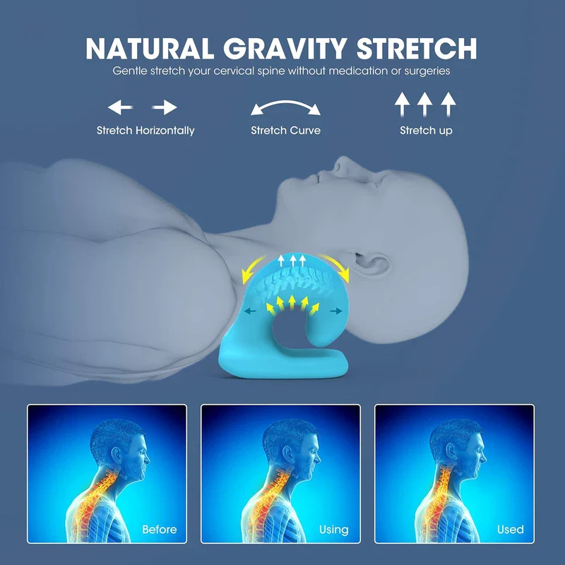 ZAMAT Neck and Shoulder Relaxer with Magnetic Therapy Pillowcase, Neck Stretcher Chiropractic Pillows for Pain Relief, Cervical Traction Device for Relieve TMJ Headache Muscle Tension Spine Alignment - Image 5
