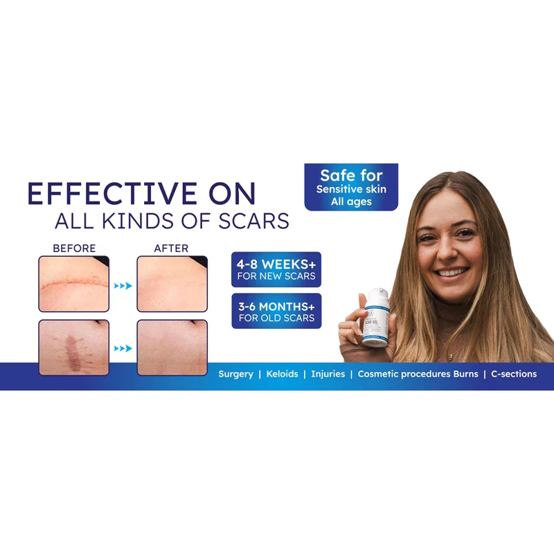 ZaynAura Advanced silicone Scar Gel 1.7floz (medium) - Image 7